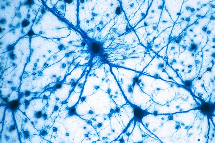 Microscopic view of neurons in a mouse brain with reduced tau protein aggregates after treatment.