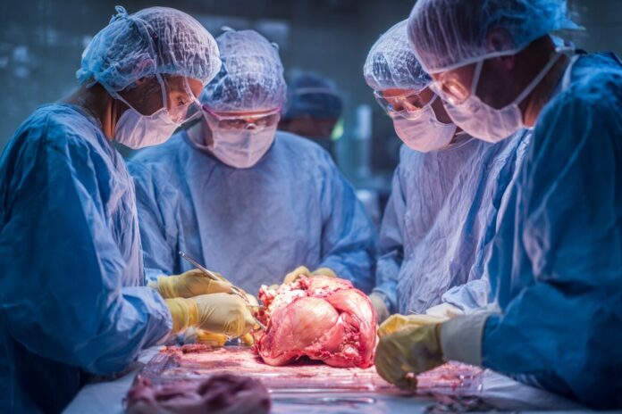 Surgeons preparing to transplant a genetically modified pig lung for research purposes